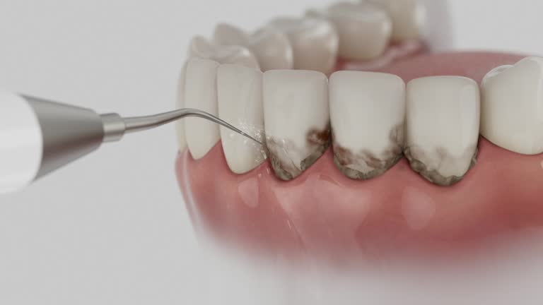 Reliable Dental Implants contractor in Richton, MS by Smile Center Dentistry